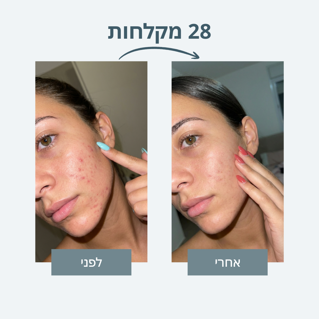 ראש מקלחת עם סנן - Sealk