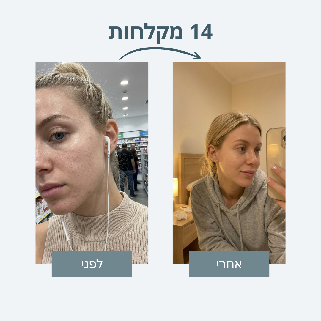 ראש מקלחת עם סנן - Sealk